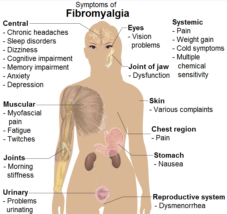 Fibromyalgia