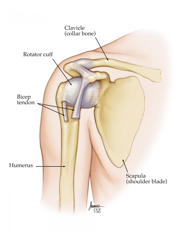 Shoulder Impingement