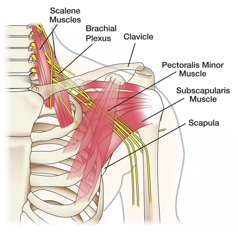 Brachial Plexus Injury 